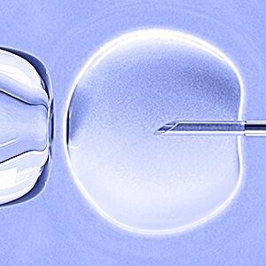 We had an unsuccessful IVF / ICSI therapy in another fertility center!